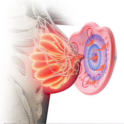 Wireless Breast Massager